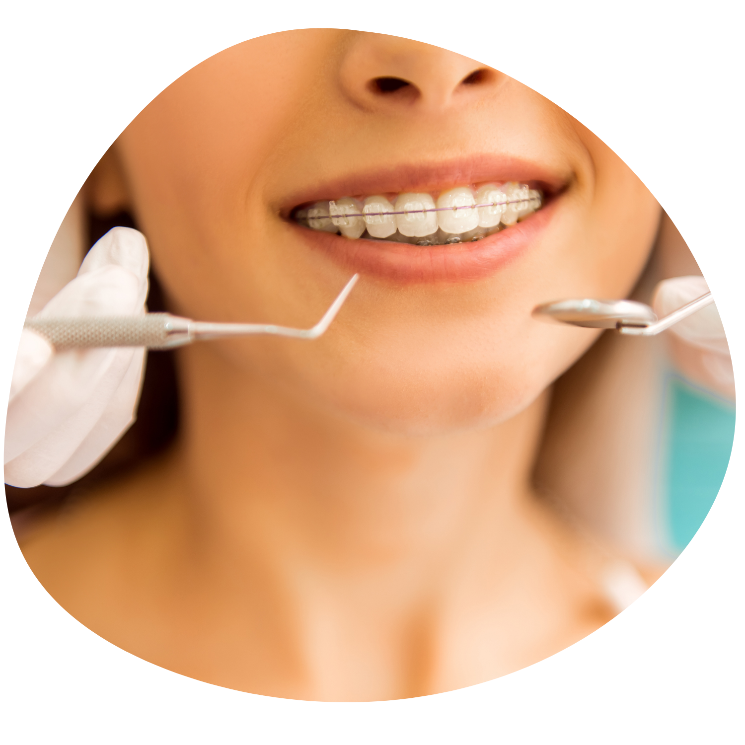 Lachgas Dresden (1) http://bitte-laecheln.maximilian-schneider.info/wp-content/uploads/2021/11/Lachgas-Dresden-1.png